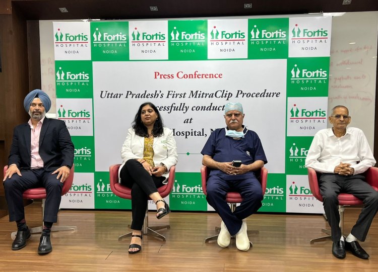 उत्‍तर प्रदेश में पहली बार मिट्राक्लिप प्रक्रिया नोएडा स्थित फोर्टिस हॉस्‍पीटल में 66 वर्षीय मरीज़ पर सफलतापूर्वक संपन्‍न